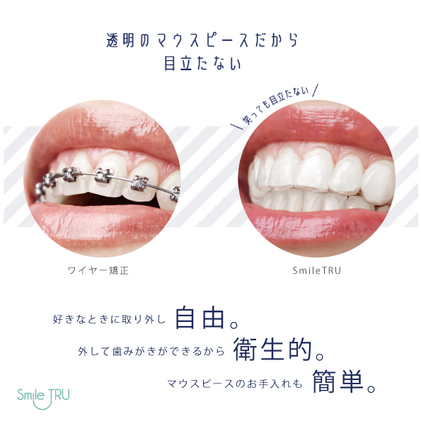 特徴